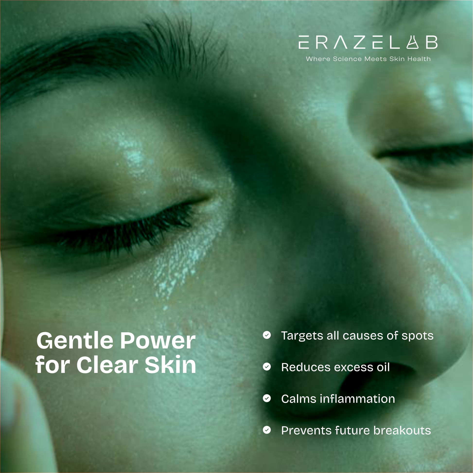 Erazer - Acne Control Lightweight Fluid